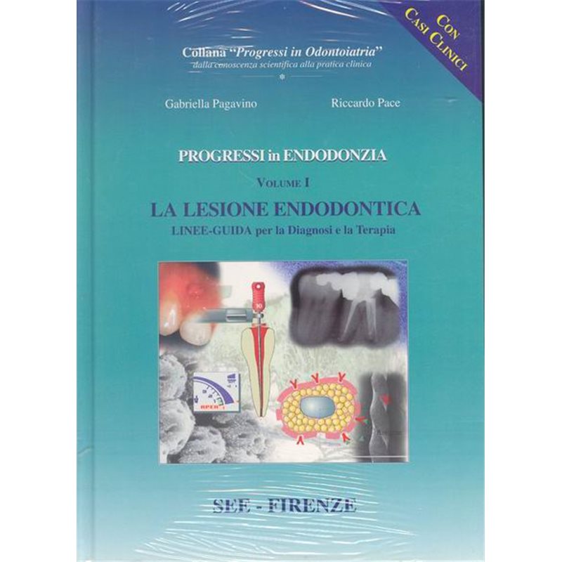 Progressi in Endodonzia. La LESIONE ENDODONTICA - Linee-guida per la Diagnosi e la Terapia Vol. 1